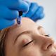 Microneedling Facial
